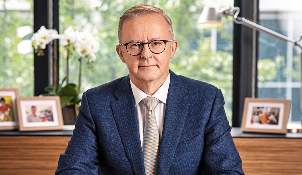 Anthony Albanese