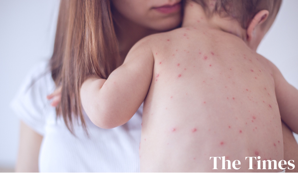 Measles is very bad for babies